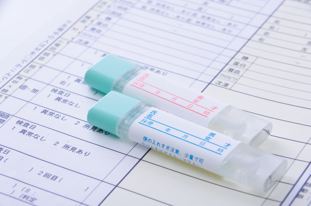 便潜血検査について